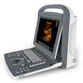 Ultraschall Ultraschall-Scanner schwarz weiße Doppler Laptop Portable (SC-ECO2)